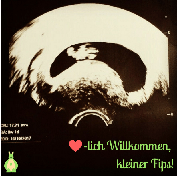 Herzlich Willkommen! Ultraschall 8. SSW